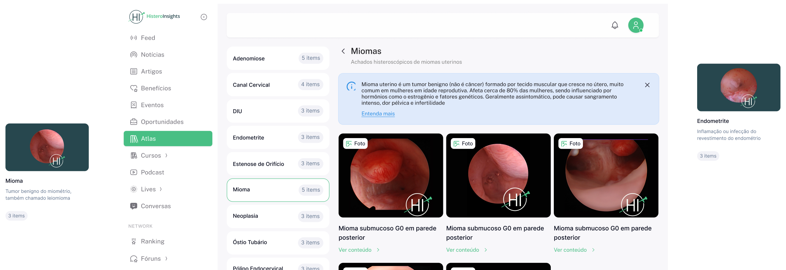 Plataforma Histero Insights — atlas de histeroscopia
